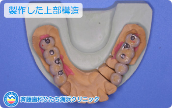 制作した上部構造